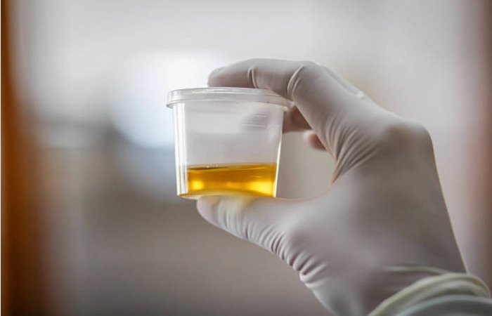 Diabetics’ urine can be transformed into whiskey due to high sugar content.